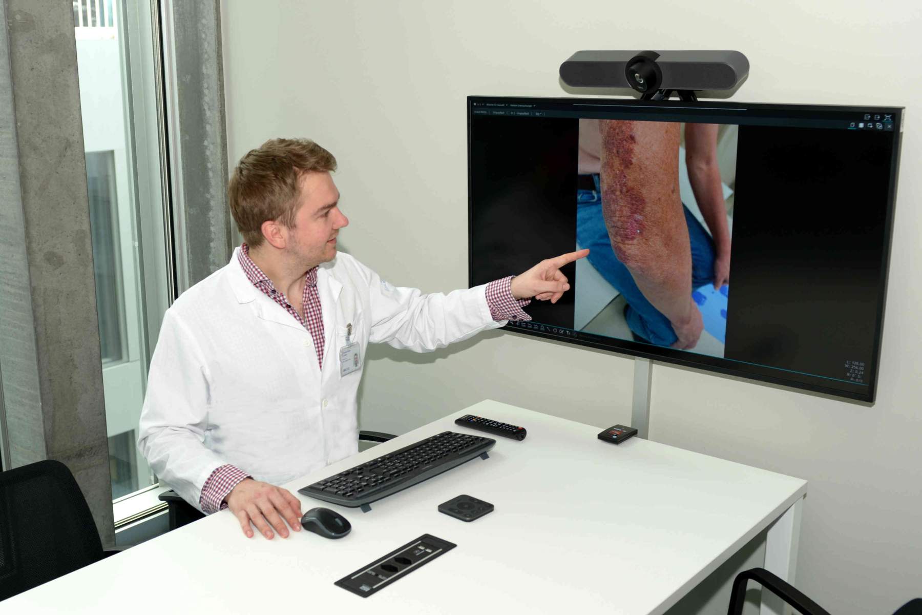 Teledermatologie: Online-Hautarzttermin ohne Wartezeit und Anfahrt