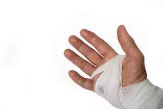 Handchirurgie