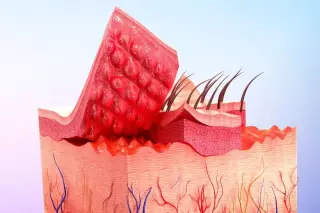 Ihr Ratgeber zum Thema Hauterkrankungen