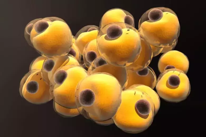 Wenn zu viel Fett zur Bedrohung wird: Ein Blick auf die Hypertriglyceridämie