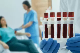 Blutwerte bei FMF – Was sagen sie über die Erkrankung aus?