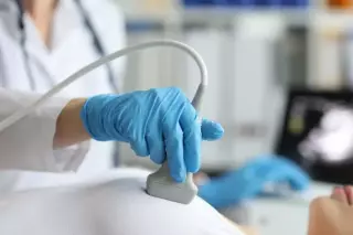 Krebsvorsorge