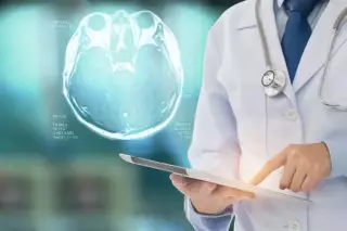 Neurologie